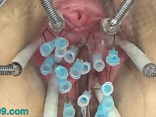 Innovative German Bondage & discipline Nearby a flame up medial Cooch Cervix enlargened at the end of one's tether Gut